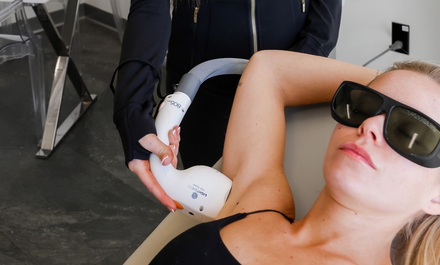 Image 3: Up to 60% Off on Laser Hair Removal at TC Skin and Laser