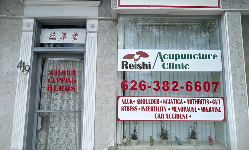 Image 3: Recharge Your Energy with Acupuncture Session with Cupping Treatment