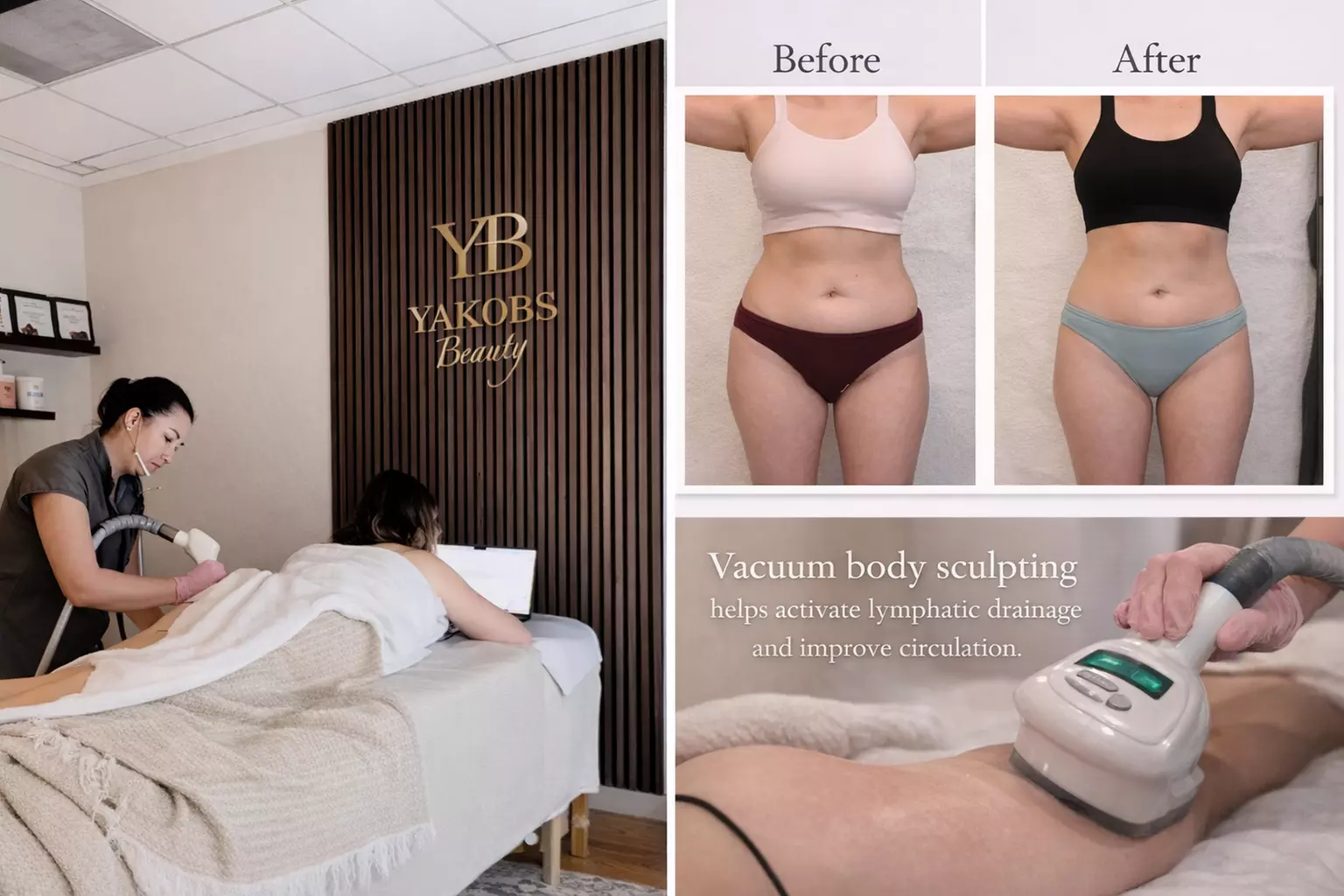 30 or 45 Min Vacuum Massage, 3 Vacuum Anti-Cellulite Sessions & More