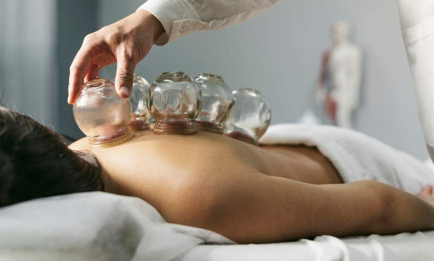 Image 5: Revitalize with 1 or 3 Acuwave Detox Cupping Sessions for 30 Mins