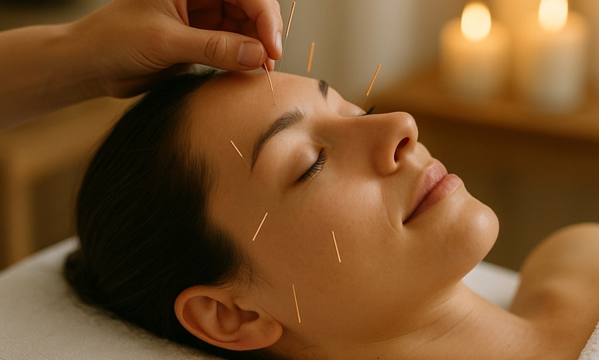 Image 1: Health Review + Acupuncture & Cupping or Gua Sha treatment with Doctor of Acupuncture at Dao Integrated Health (Up to 61% Off)