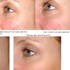 Image 2: Transform Your Skin with Laser Genesis Session at Vascular Cosmetics