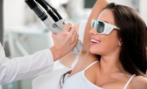 Laser Hair Removal