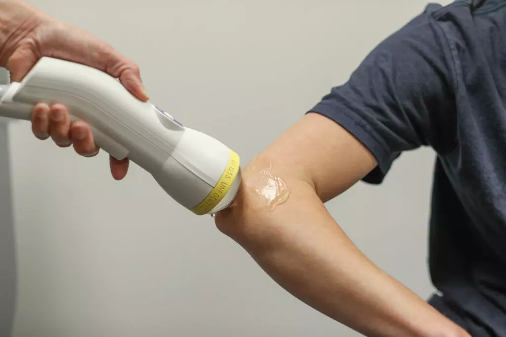 Experience Quick Relief with 1, 2, or 3 Sessions of Shockwave Therapy