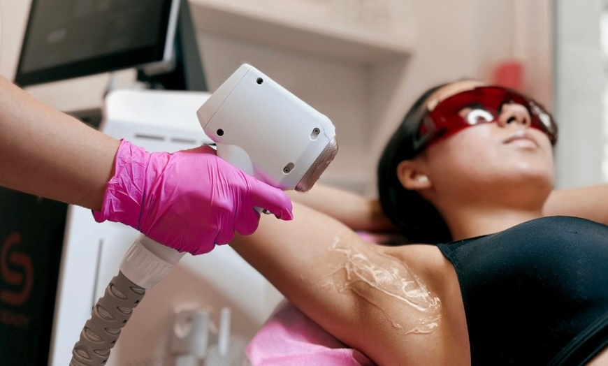 Image 6: Do 40% zniżki na: Depilacja laserowa w DS Beauty