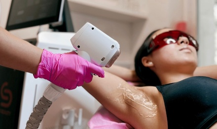 Depilacja laserowa dla kobiet: broda lub wąsik  - Olena Kukhar