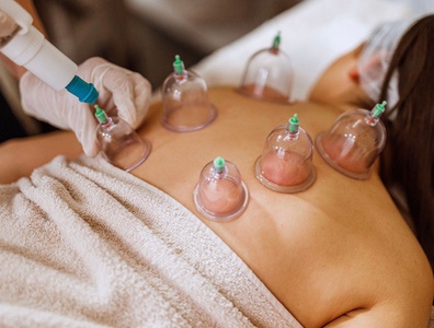 Hijama Wet cupping with FREE 10 minute targeted massage - Leveyna
