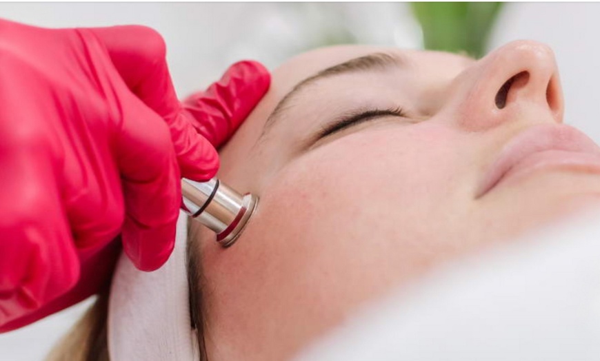 Image 1: Up to 60% Off on Microdermabrasion at Glow Matrix