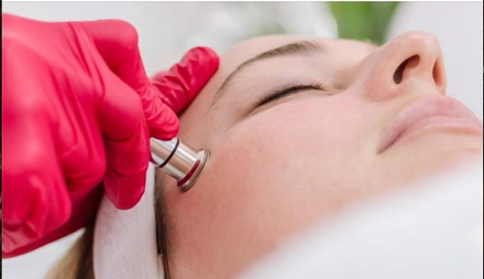 Revolution Acne Facial and Microdermabrasion  - One session - Glow Matrix