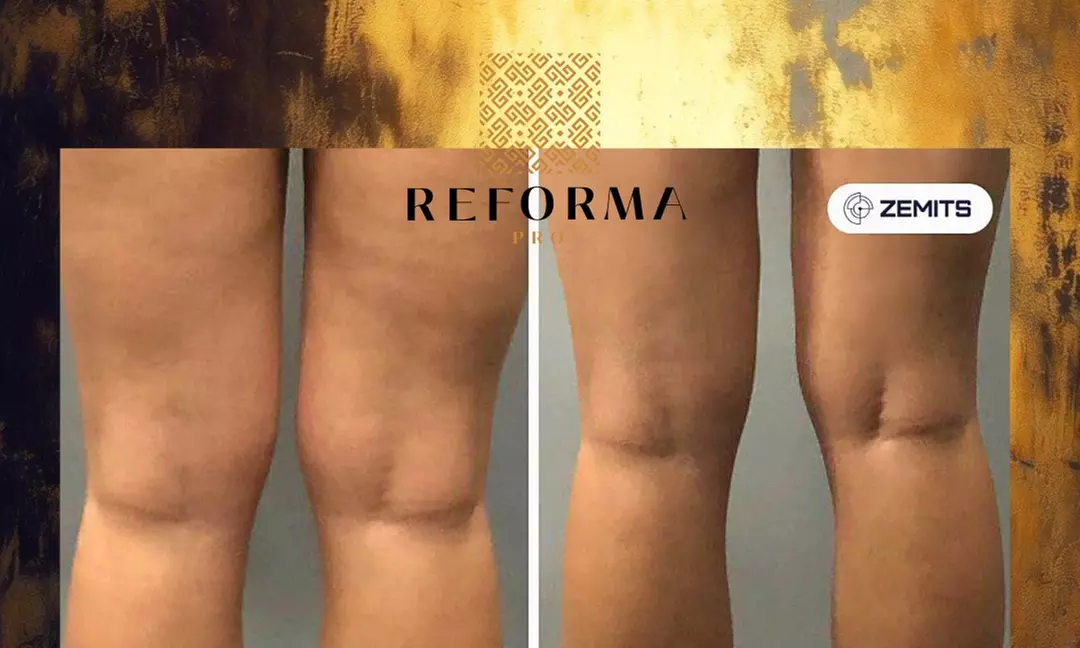Modelowanie sylwetki i detoks: EMS, sauna IR, presoterapia (3 w 1)