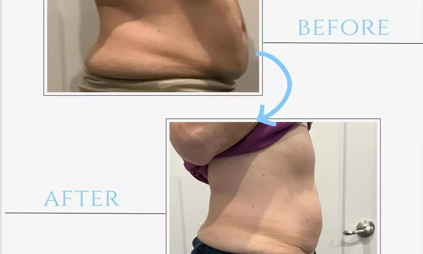 6-Week Sculpt & Shine: Elite Body Reset Program - Dallas