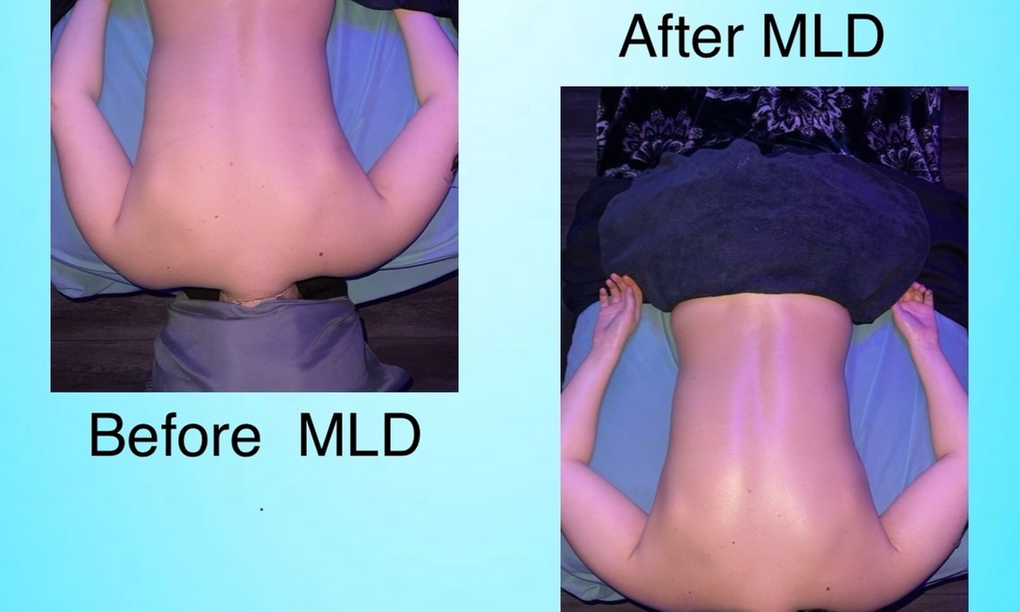 Manual Lymphatic Drainage (60 Min)