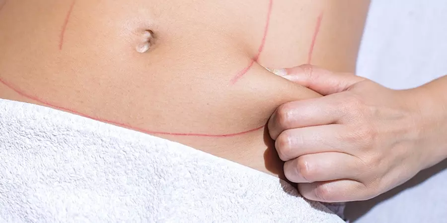 Up to 65% Off on Ultrasonic Fat Reduction at UK Aesthetics Lounge