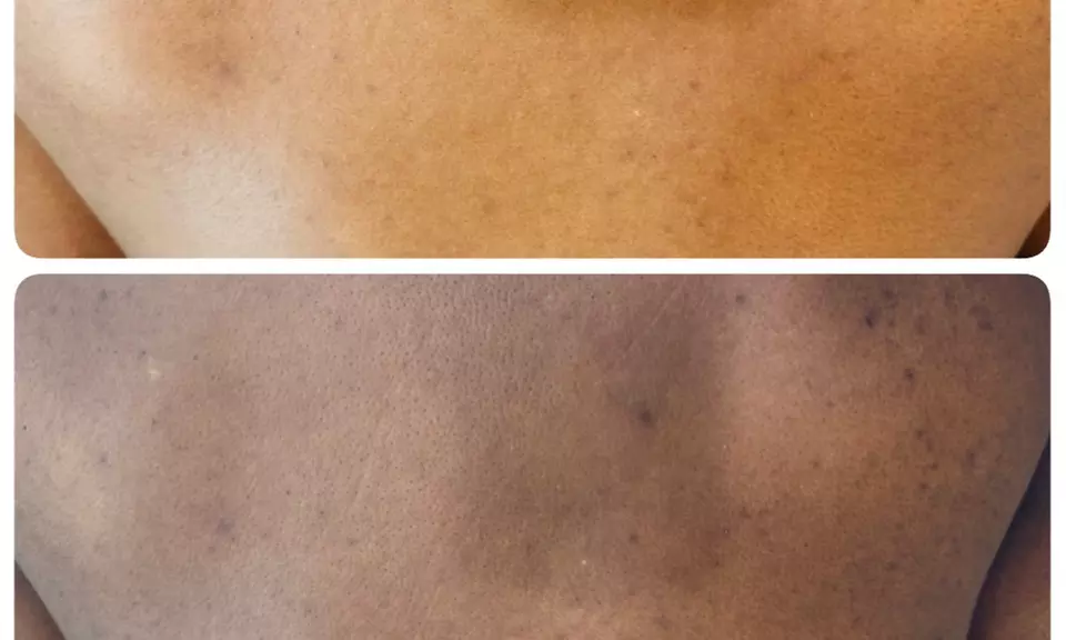 Revitalize Your Back with a 55-Minute Facial Treatment