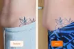 Cryotherapy Sprays & Massage: 1, 3, or 5 Session Wellness Boost at Ai stretch (Up to 30% Off) - Second Medium
