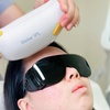 Image 1: One or Two Stellar M22 IPL Photofacial Treatments for Radiant Skin