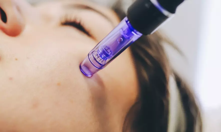 Up to 70% Off on Micro-Needling at Revive Medical Spa - Primary Image