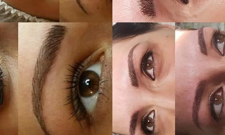 Image 6: Up to 58% Off on Injection - Dermal Filler at Ana Medical