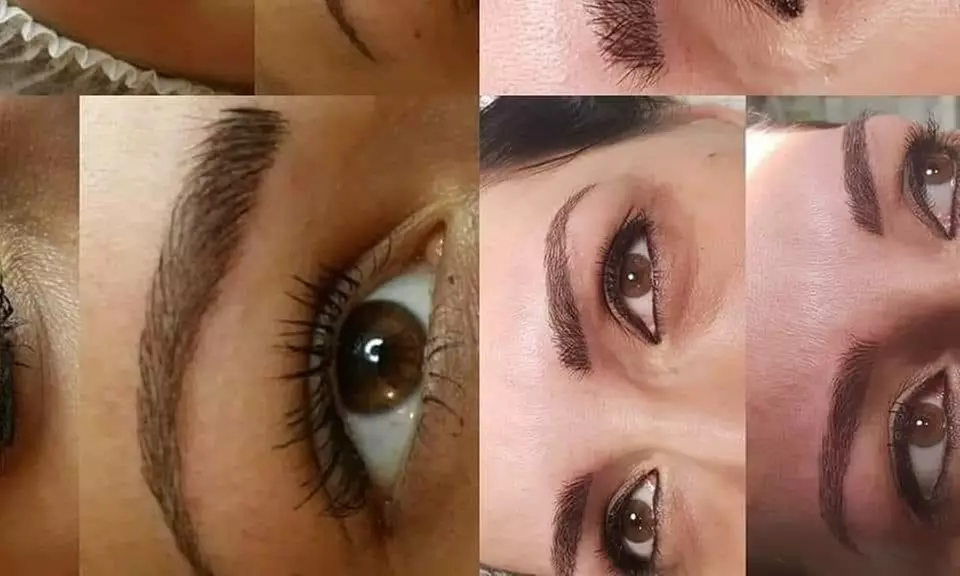 Up to 58% Off on Injection - Dermal Filler at Ana Medical