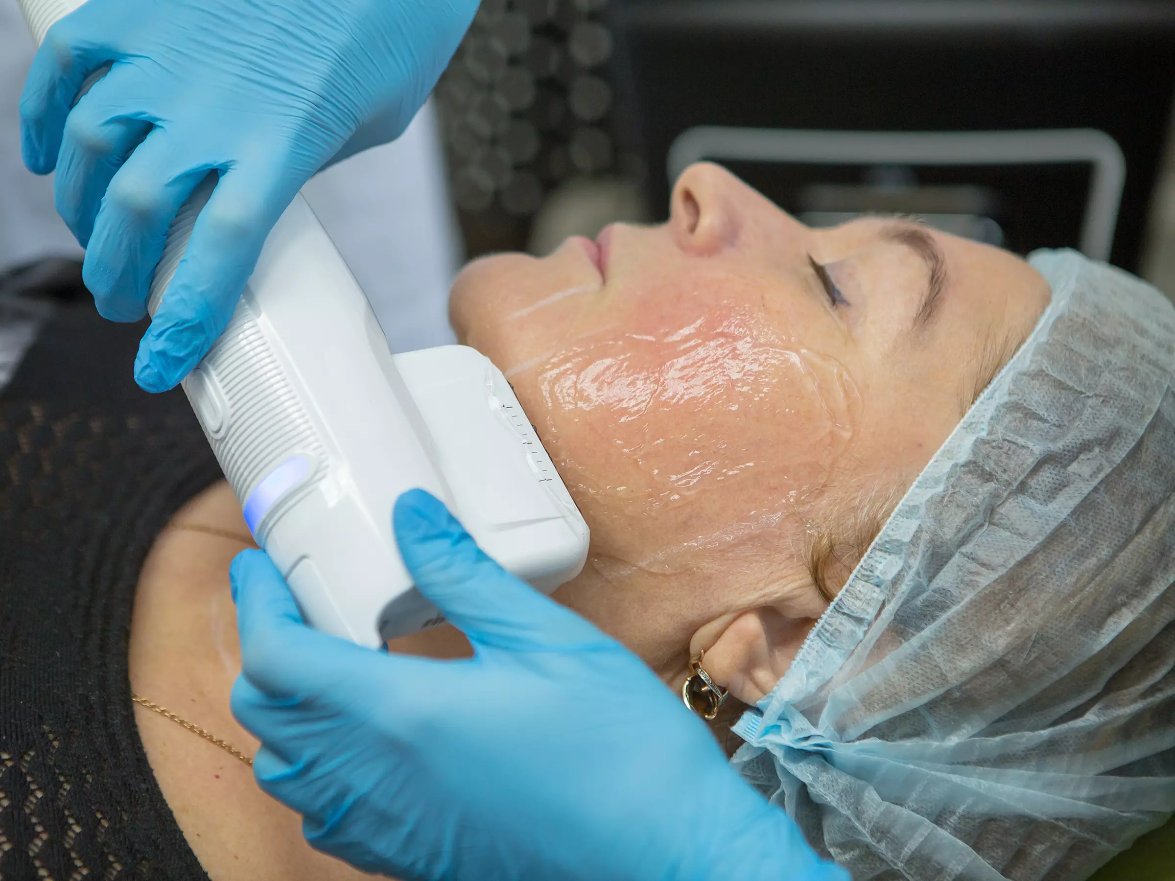 Skin Tightening & Lifting with Advanced Non-Surgical HIFU Facelift