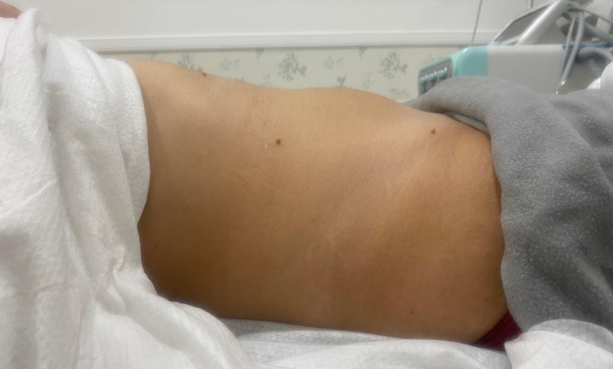 Image 6: 3 o 6 sesiones de lipoláser, radiofrecuencia y presoterapia