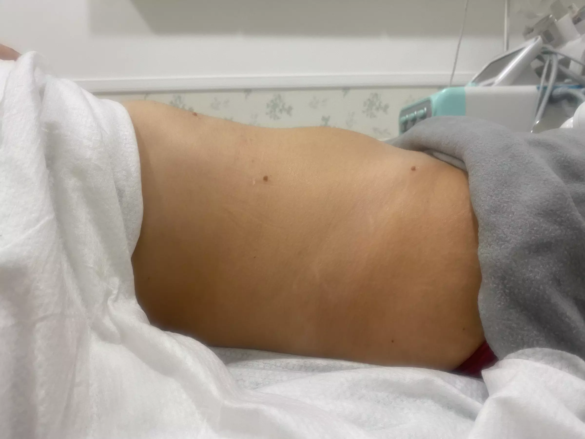 3 o 6 sesiones de lipoláser, radiofrecuencia y presoterapia