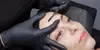Achieve Smooth Skin with a Dermaplane Treatment at Gentlelase Laser Aesthetics, offering up to 70% off