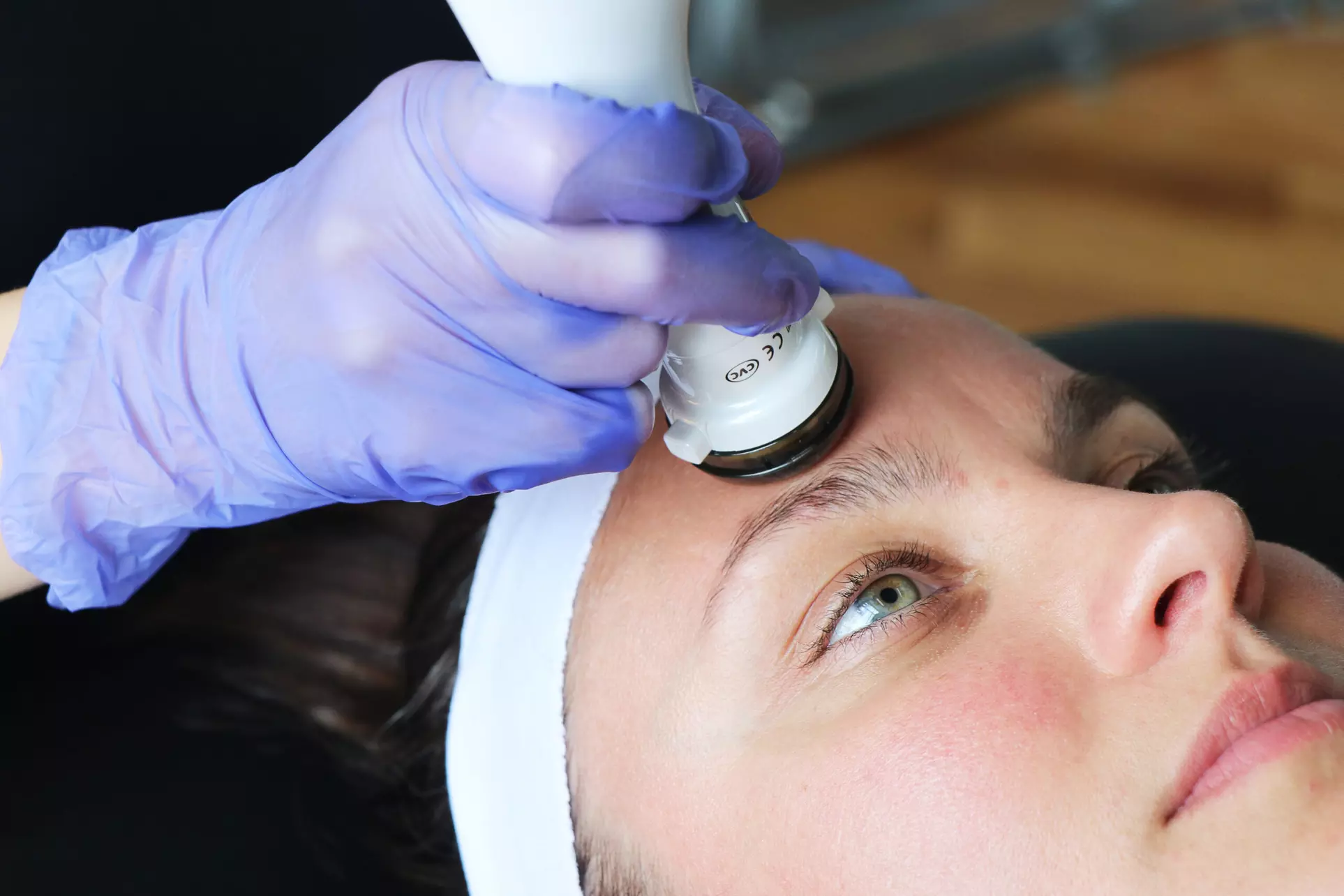 Say Goodbye to Acne: Plason Plasma Clear Acne Treatment Plan