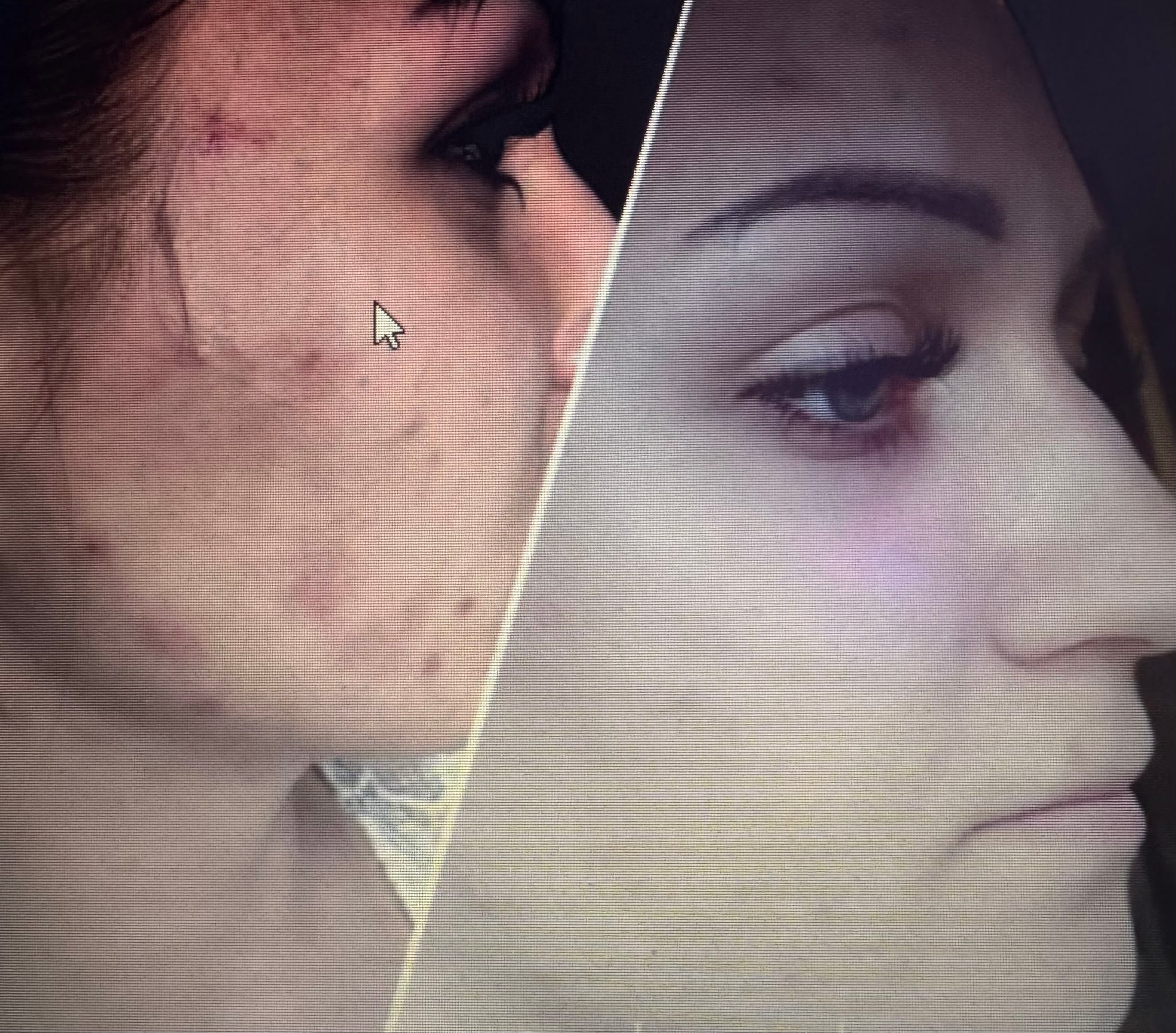 Lift and Firm Your Skin with Mesotherapy Magic