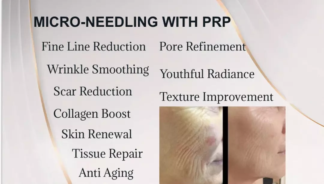 Up to 25% Off on Salon - Beauty Package with Choice of Service(s) at Clinic of Aesthetics - Primary Image