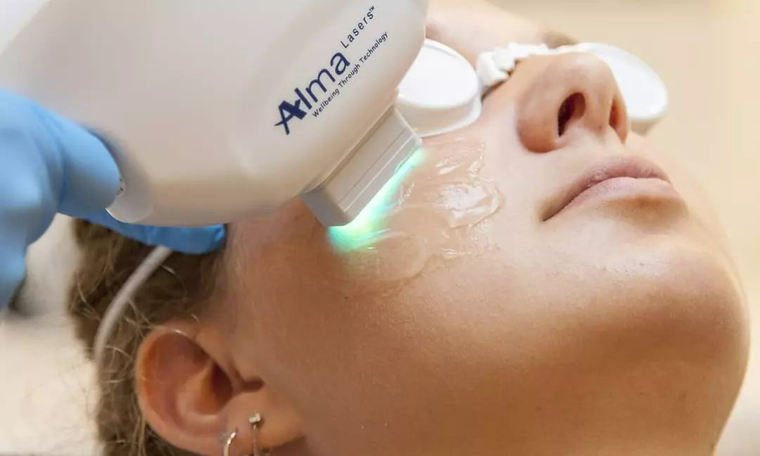 Transform Your Skin at Posh N Plush Spa: One, Three, or Six 3D IPL Treatments(Up to 45% Off) - Primary Image