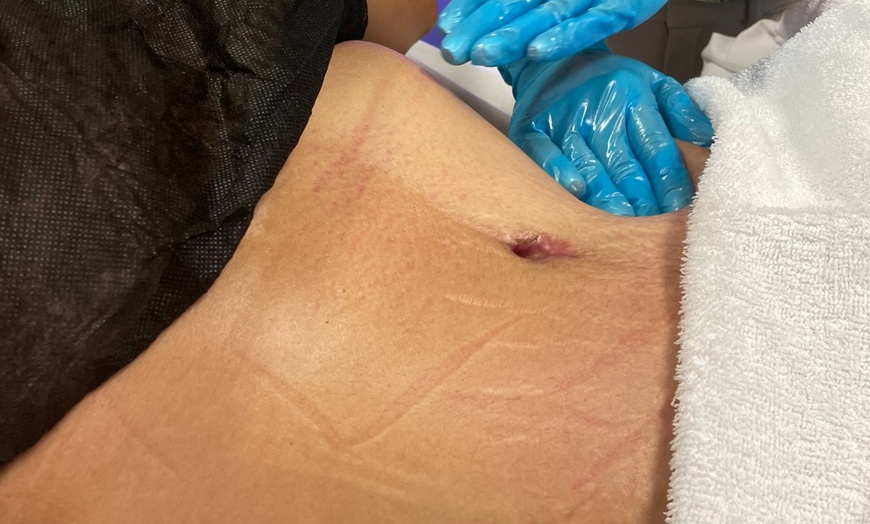 Image 8: Lymphatic Drainage Massage at Bambu |Post-Op Care & Lymphatic Drainage