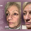 Image 7: Up to 38% Off on Injection - Dermal Filler at Divine Aesthetics Clinic London