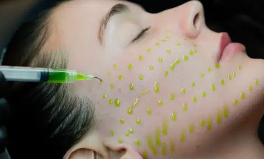 Image 1: Chemical Peel Options for Rejuvenated Skin 