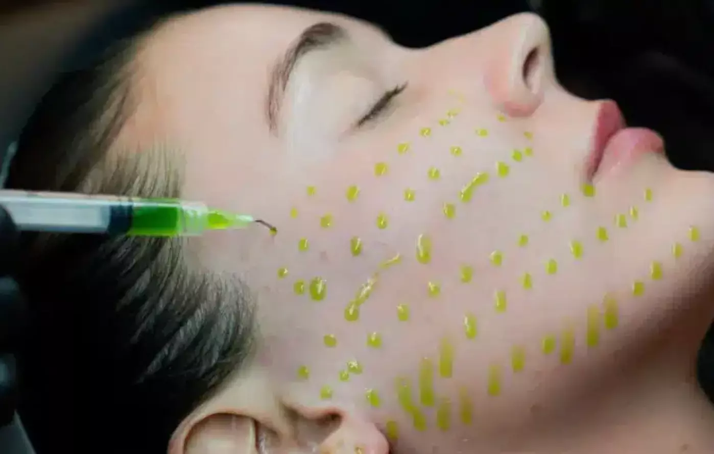 Explore Chemical Peel Options at Illumina Skin with Savings up to  35%  - Primary Image