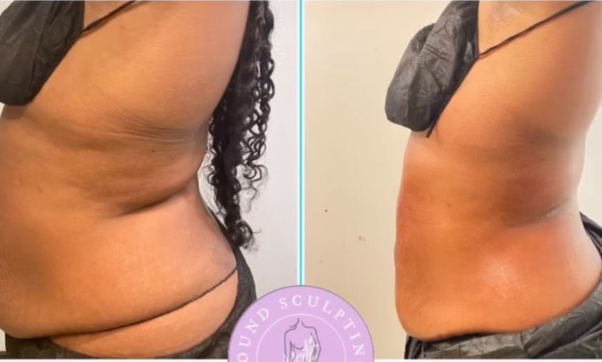 Image 4: One Hour Full Body Lymphatic Rub at Sound Sculpting Solutions