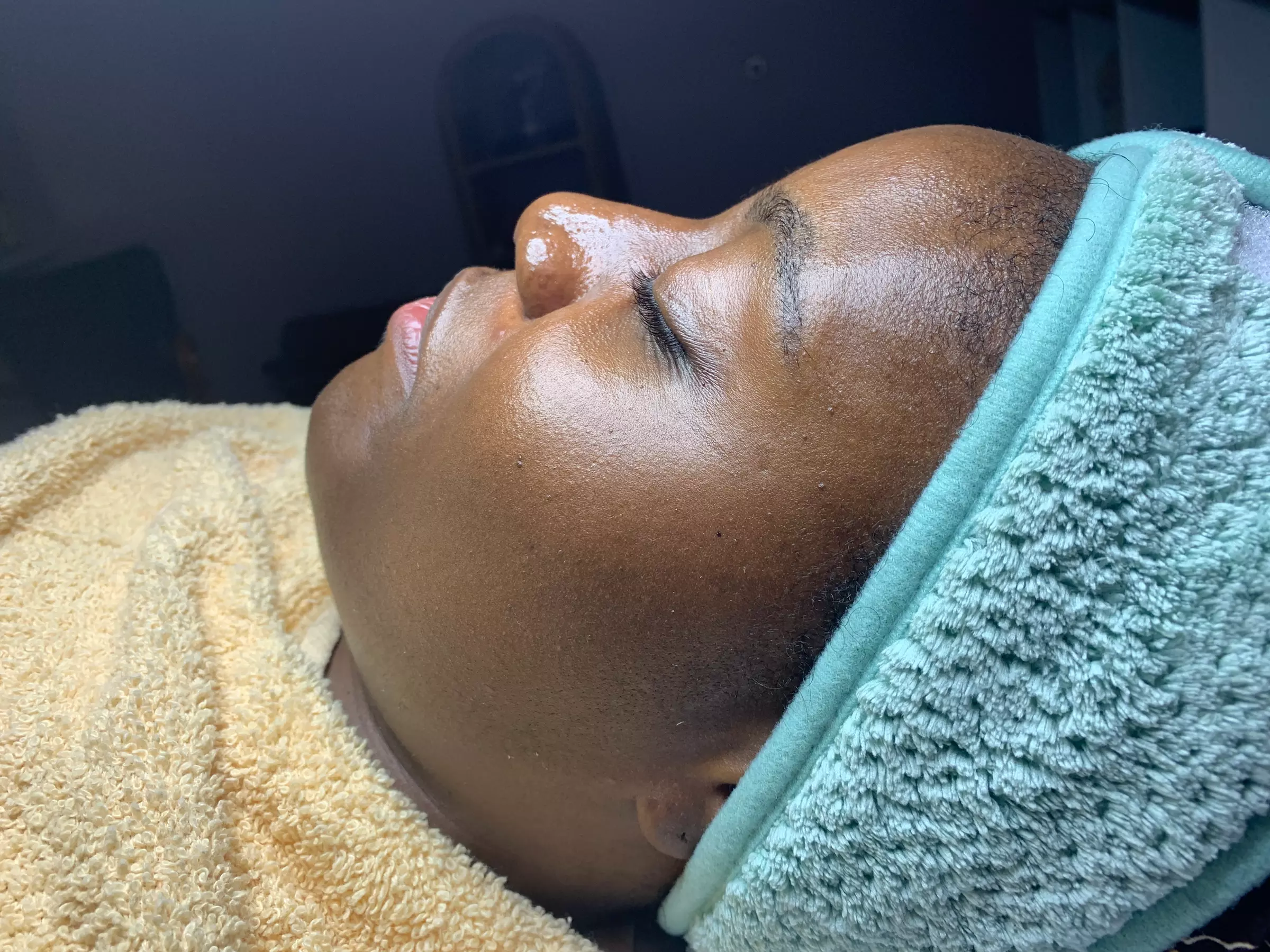 Up to 20% Off on Microdermabrasion at SaMecia Blount Natural Hair Co LLC: Solace Skin Lab - Second Medium
