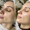 Image 5: Up to 70% Off on Facials at Euphoria Aesthetics
