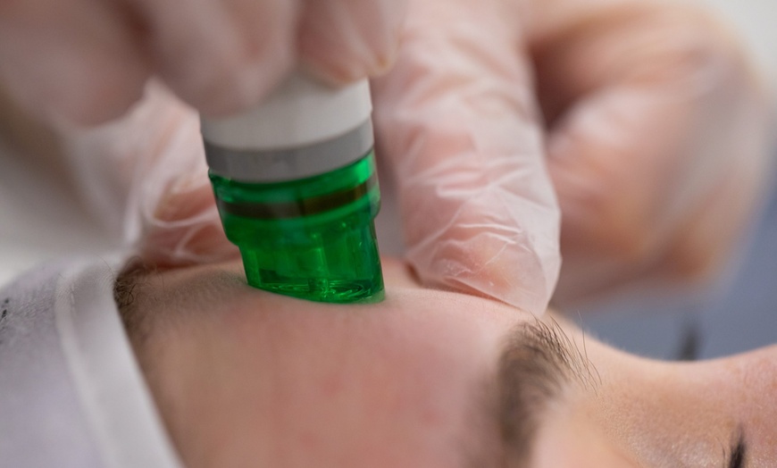 Image 9: Up to 59% Off on Facial - HydraFacial at UK Aesthetics Lounge