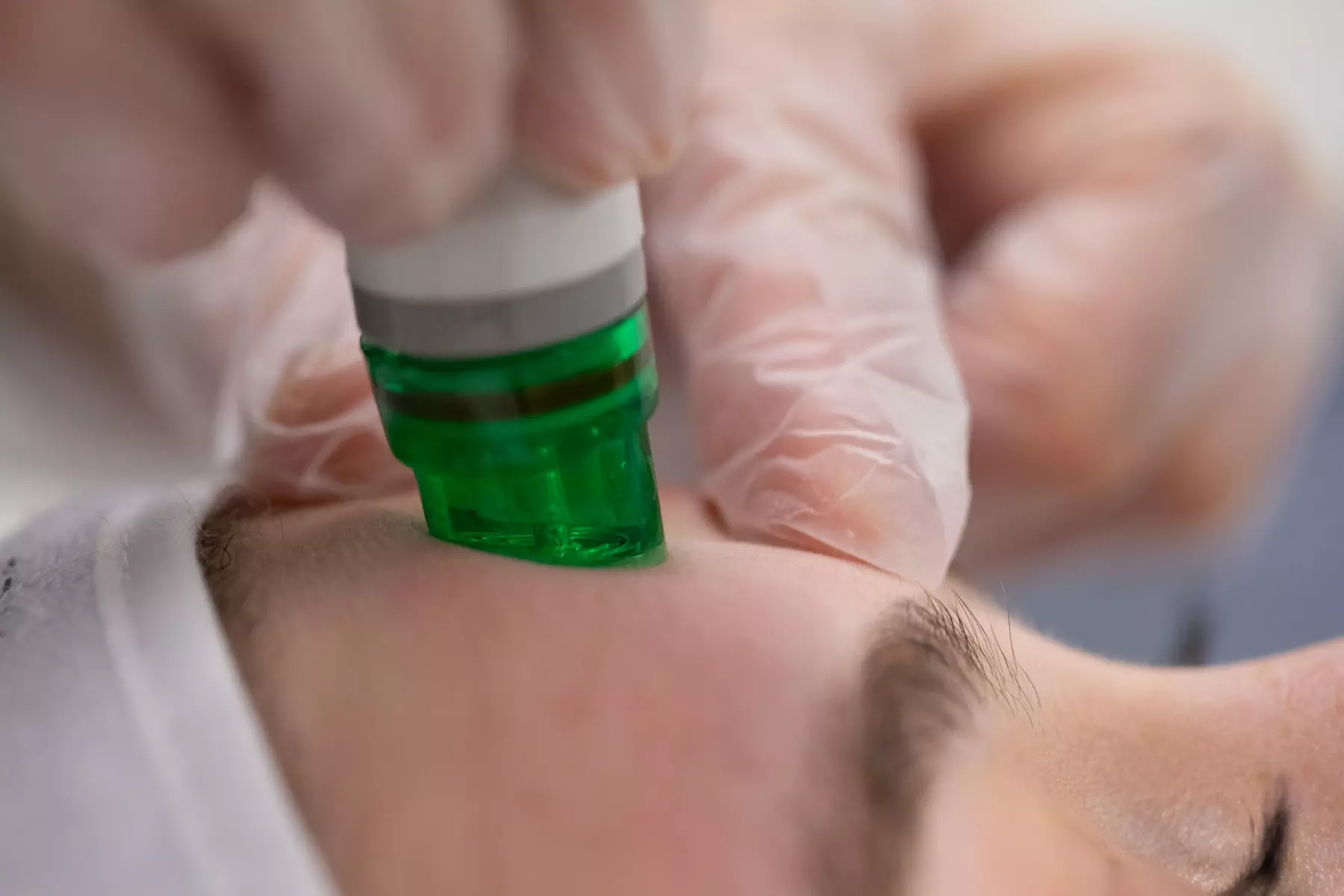 Up to 59% Off on Facial - HydraFacial at UK Aesthetics Lounge