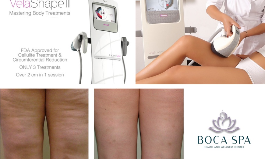 Image 4: Three, Six or Nine Sessions of VelaShape