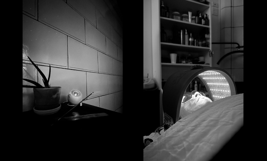 Image 2: Up to 44% Off on Facial at Zydrate Skin