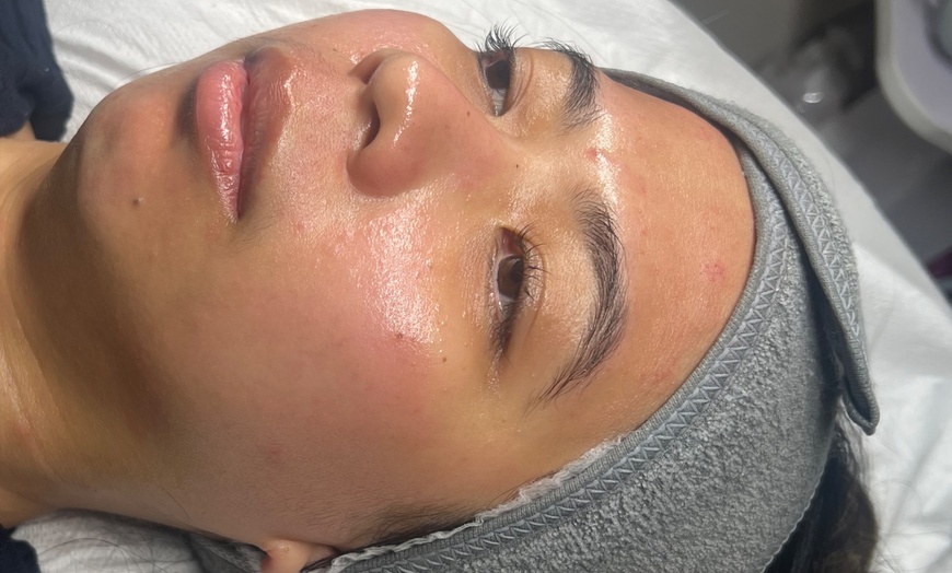 Image 9: Up to 59% Off on Facial - HydraFacial at RefreshSkinTherapy