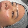 Image 9: Up to 59% Off on Facial - HydraFacial at RefreshSkinTherapy