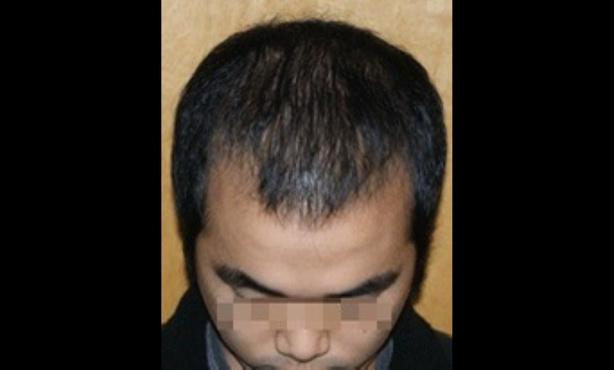 Image 4: Hair, Scalp Analysis and Take Home Product with Optional Treatment