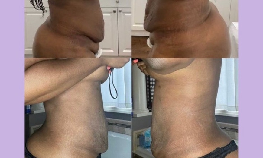 Image 2: Lymphatic Drainage Massage at THAE Beauty Studio