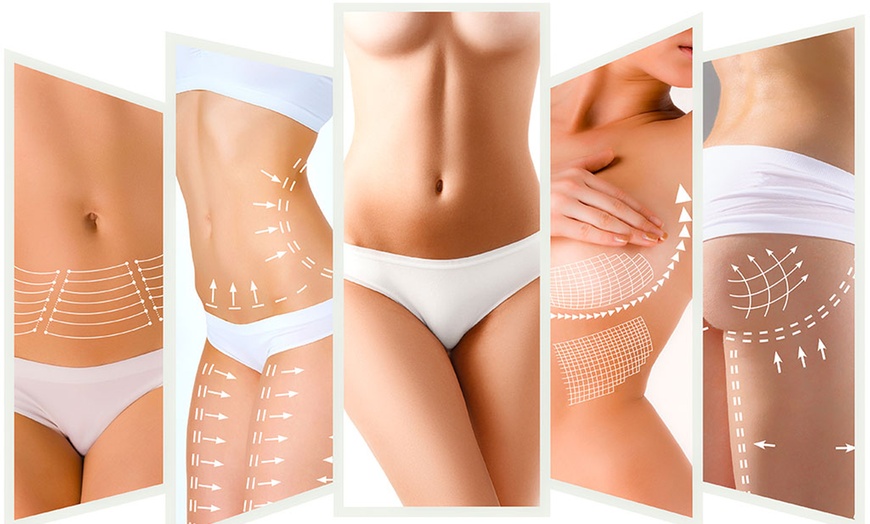 Image 1: Up to 58% Off on Radio Frequency Skin Tightening at UK Aesthetics Lounge