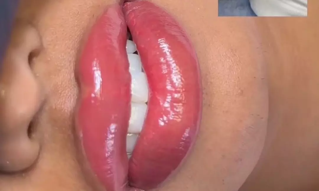 Organic Lip Blush Tattoo or Natural and Organic Lip Neutralization