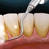 Image 2: Achieve Beautiful Smile w/ Professional Dental Care or Teeth Whitening