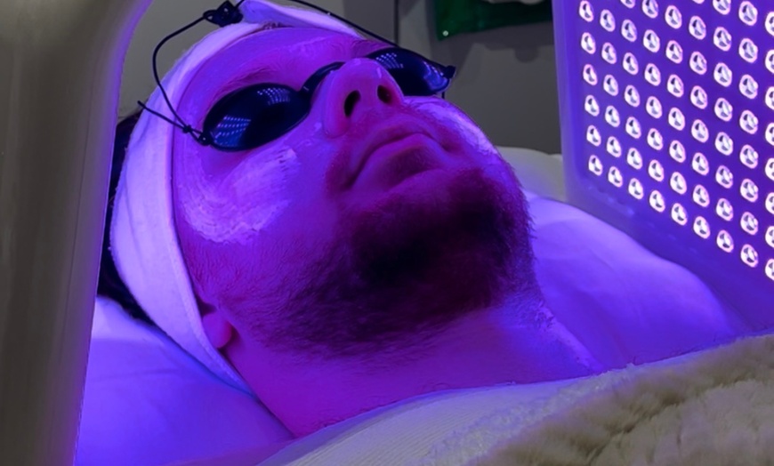 Image 4: Up to 54% Off on HydraFacial at Kolcheva Skin and Laser clinic